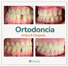 ortodonciaz3.jpg